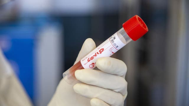 US adds another 500K COVID-19 cases in 1 week, a new record