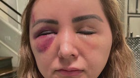 Reward offered after Sugar Land woman attacked while taking out trash