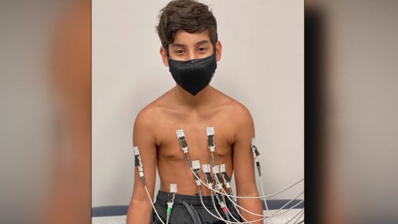 Doctors concerned about long-term effects of COVID-19 on children