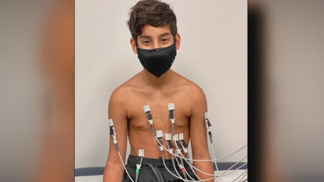 Doctors concerned about long-term effects of COVID-19 on children