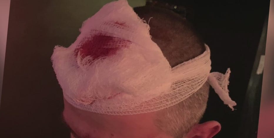 Houston bar employee violently attacked after asking a customer to wear a mask