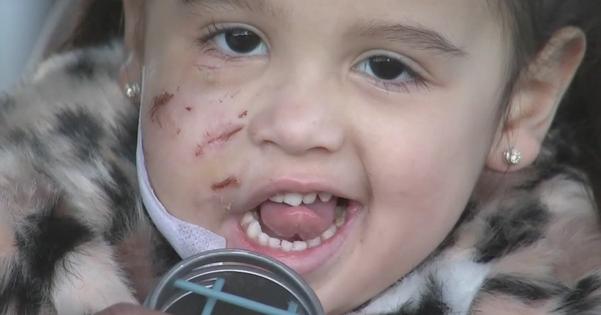 3-year-old girl recovering after being mauled by dog in Spring | FOX 26 ...