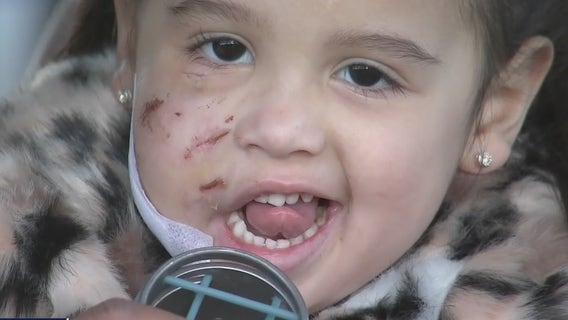 3-year-old girl recovering after being mauled by dog in Spring
