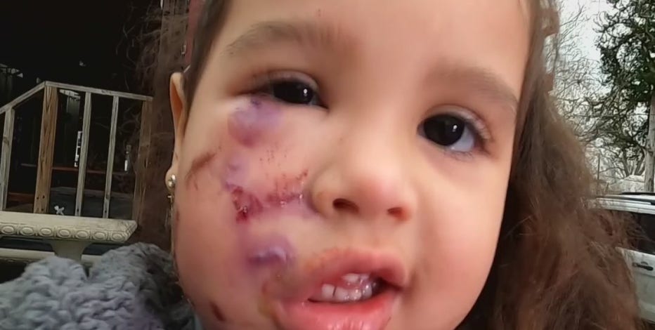 Dog accused of attacking 3-year-old girl taken to animal shelter in Montgomery Co.