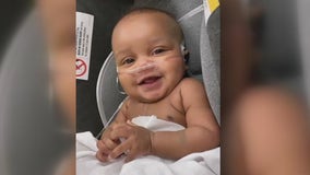 Houston doctors help save baby with unusual heart defect from Mississippi