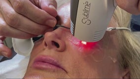 New treatment for dry eyes also zaps wrinkles