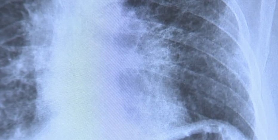 Doctor says all-natural treatment for COVID-19 shows promising results