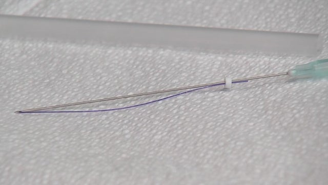 Houston woman feels more youthful after PDO thread lift