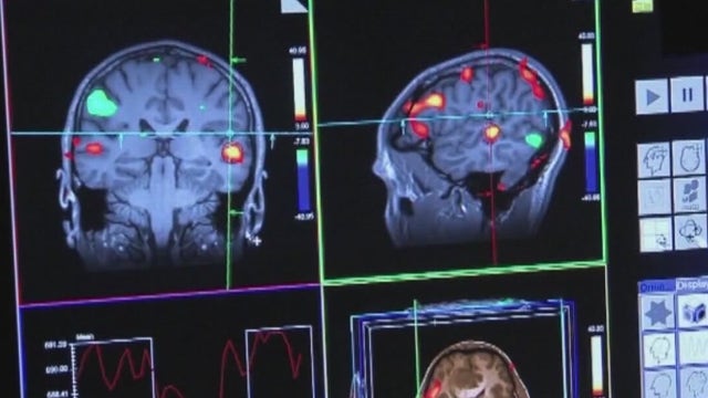 FDA approves new medication in fight against Alzheimer's