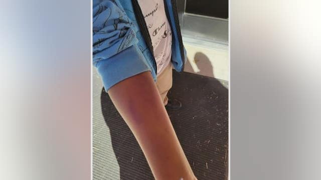 Houston mom says her 12-year-old daughter was bruised by teacher at school