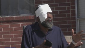Seabrook man claims violent beating by stranger was racially motivated, authorities investigating