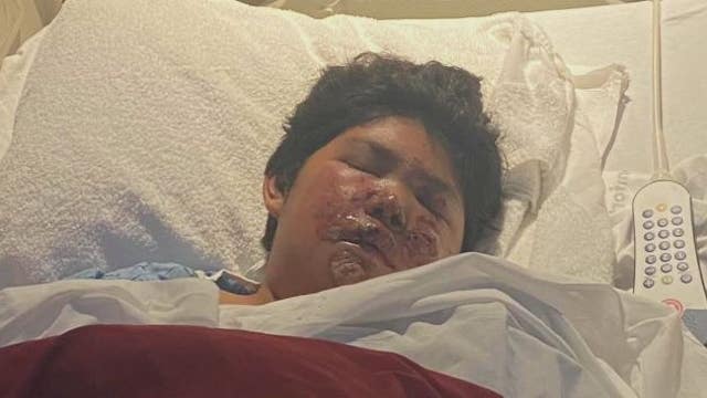 11-year-old hit by truck and left to die in Harris Co., family now asking for help