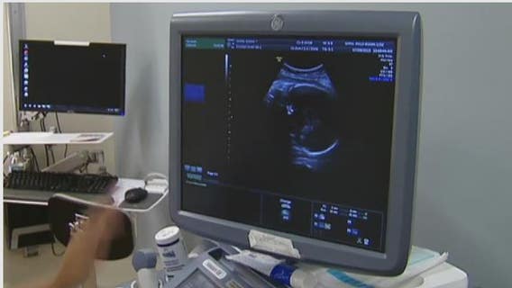 The Breakdown: SCOTUS hears abortion argument