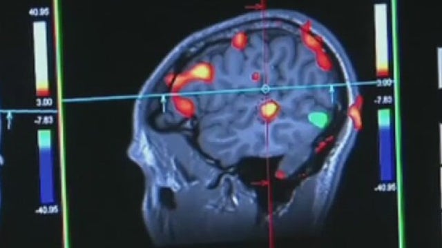 Viagra may reduce risk of Alzheimer's disease - What's Your Point?