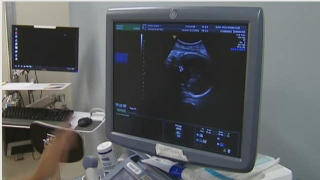 The Breakdown: SCOTUS hears abortion argument