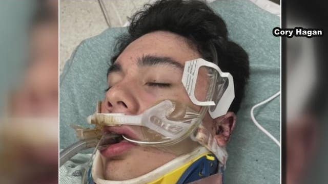 Family of Brazoswood High School football player brutally beaten by teammates says it was over a girl