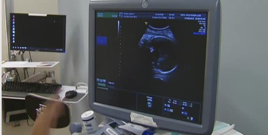 The Breakdown: SCOTUS hears abortion argument