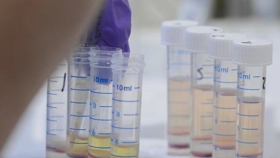 Texas Heart Institute studying how stem cells treat heart failure