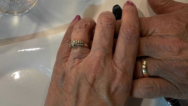 Wedding rings stolen from grandmother after husband dies of COVID
