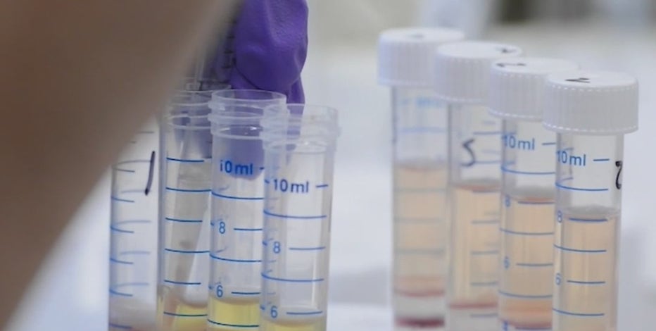 Texas Heart Institute studying how stem cells treat heart failure