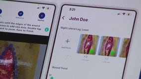Houston nurse creates app to help nurses provide virtual wound care