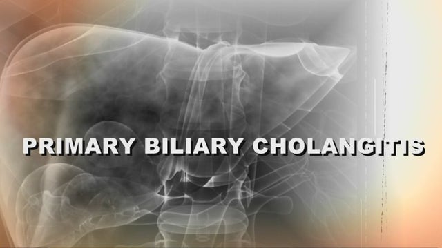 Rare Disease Awareness Day: What is Primary Biliary Cholangitis (PBC)