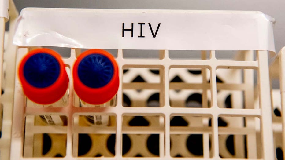 HIV blood vials