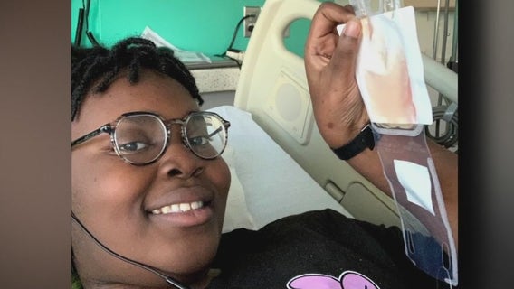 Houston teen first in Texas to become own donor to reverse sickle cell anemia