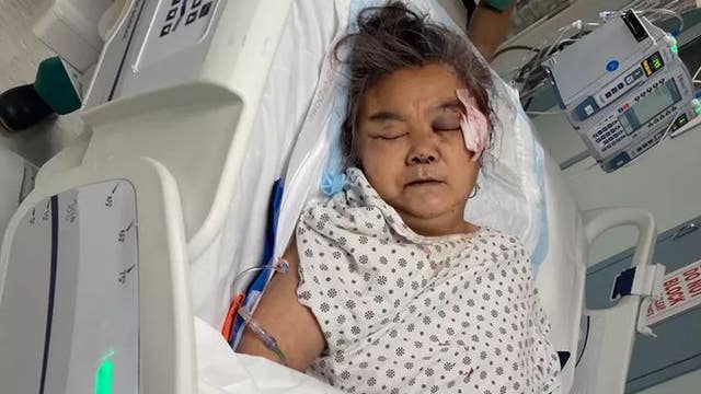 Asian grandmother hit in head with rock dies 3 months later