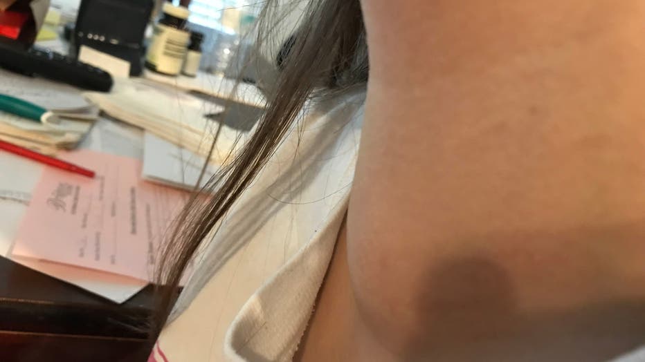Kylie's neck