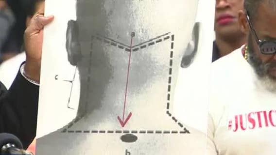 Independent autopsy reveals Jalen Randle, killed by HPD, was shot in back of neck