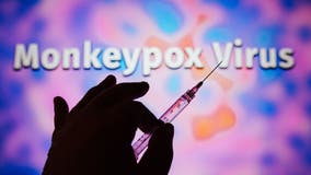 Houston health officials confirm second monkeypox case