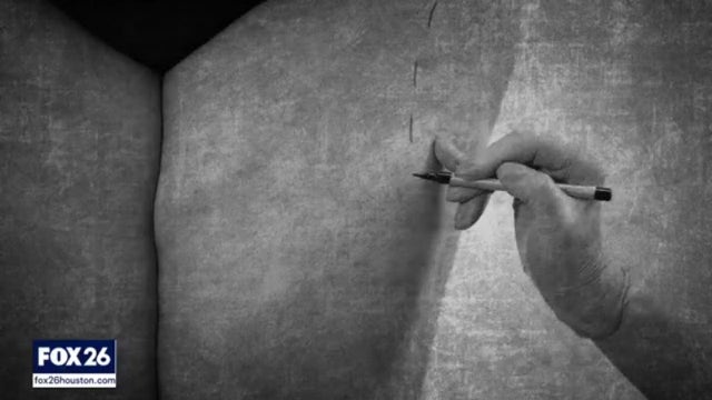 Woman says hip injections at Houston spa caused pain, disfigurement