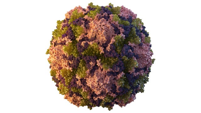 1st US polio case in nearly a decade reported in New York