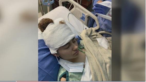 Nebraska teen with rare brain tumor gives thanks to Houston surgeon