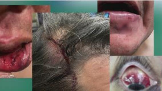 Wife believes 42-year-old husband was severely beaten outside Washington Ave bar in random, unprovoked attack