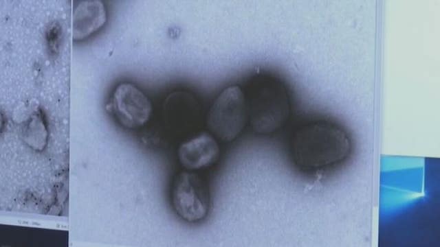 Harris County leaders asking for more Monkeypox vaccines as cases increase 120% since last week