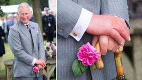 Doctor speculates over the cause of King Charles' swollen 'sausage fingers'