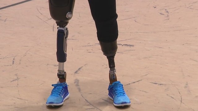 Champion amputee athlete from Houston changing lives of those with disabilities