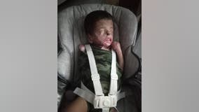 A MIRACLE: Boy born without skin is doing well, now back in Houston