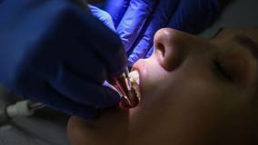 Texas ranked 5th worst state for dental health: WalletHub survey