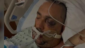 Family files federal lawsuit against Harris County Jail, claims guards beat man into a coma