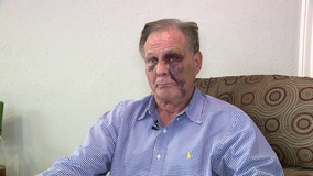 68-year-old disabled man recovering after fight with an alleged burglar almost half his age