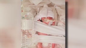 Houston miracle baby survives extreme premature birth, born at 23 weeks