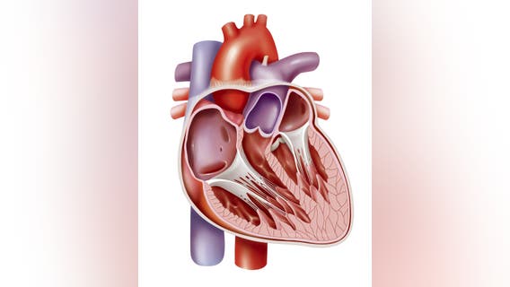 How mental health is often misdiagnosed as a cardiovascular issue