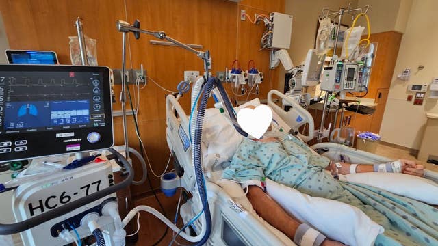 Bicyclists brutally attacked, 1 shot along popular bike trail, 2 left hospitalized