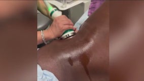 Carl Lewis tightens skin with brother after Semaglutide challenge