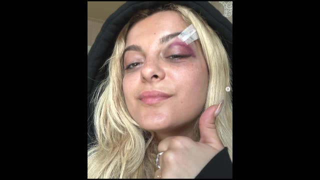 Bebe Rexha drops to knees after being hit by phone during NYC show; suspect facing felony charges