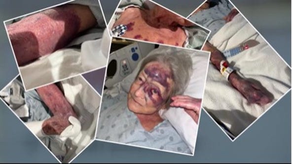 'Ongoing' investigation into Houston-area nursing home after grandmother hospitalized