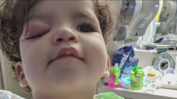 Childhood Cancer Awareness month: Houston toddler triumphs over rare eye cancer